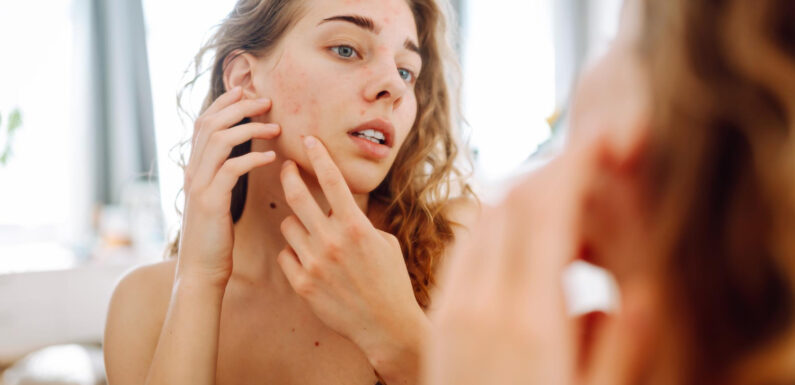 Tenul tău poate trage semnale de alarmă atunci când e vorba de ovare polichistice